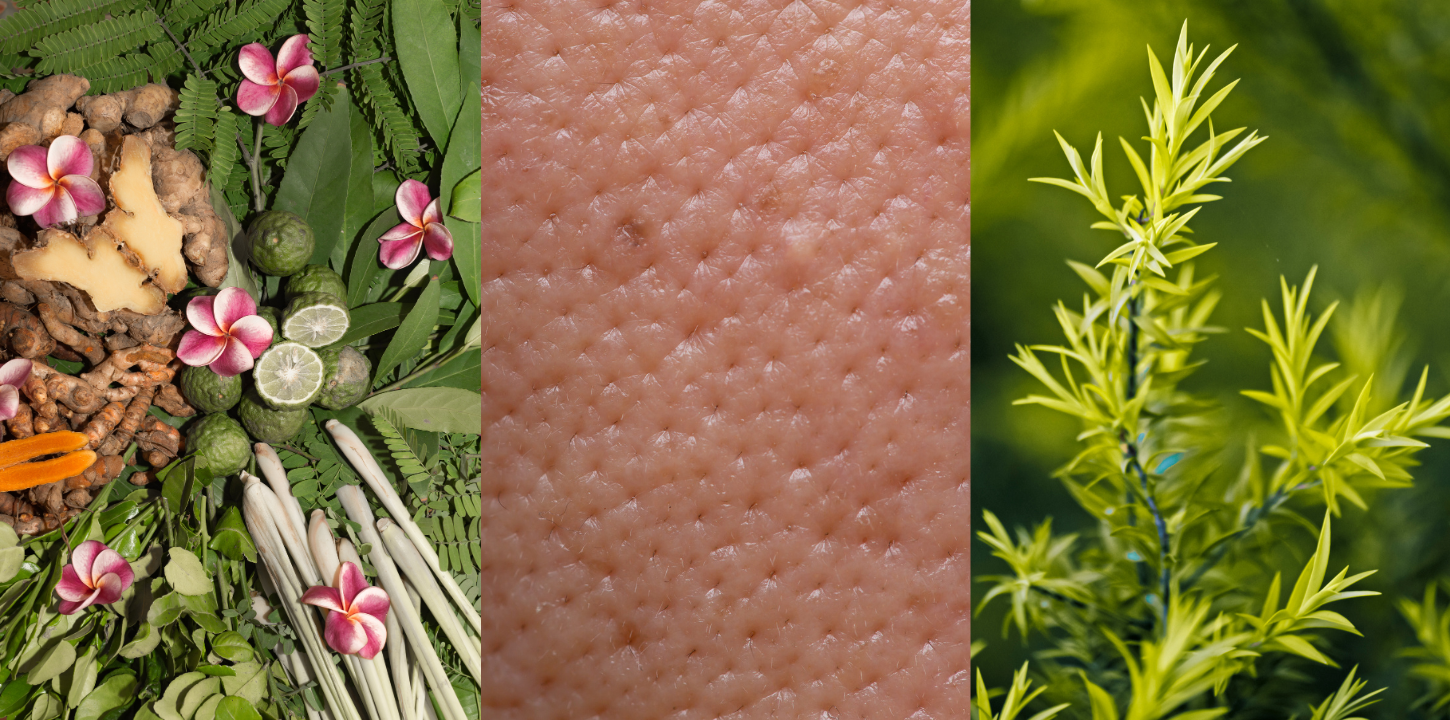 pores dilatés